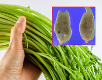 약국 구충제로는 못 없애는 간흡충… 요즘 많이 먹는 ‘이 채소’ 조심