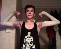 “샤워만 해도 온몸 붕대 갈아야”… 20대 男, 무슨 사연?