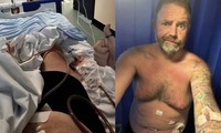 “36kg 뺀 대신 장기 썩었다”… 의사 처방 없이 ‘이것’한 남성의 후회