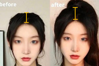 中 젊은 층, 정수리 길어 보이려 두개골에 구멍을?