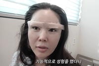 장영란, ‘이 성형’ 이후 자신감 생겼다는데?