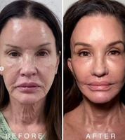 ������ ��� �¾�?�� 40���� ������ 71�� ��𵨡� ���� �ü��� ..
